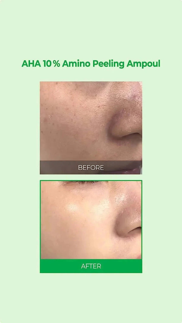Pīlinga ampula Some By Mi AHA 10% Amino Peeling Ampoule