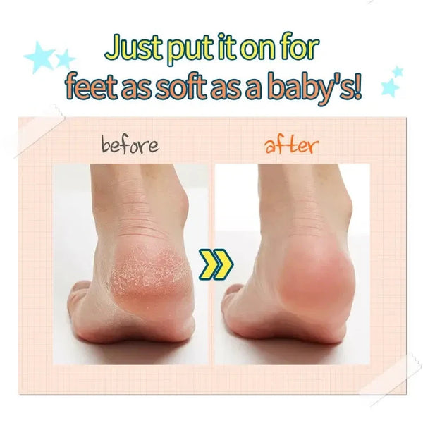 Pīlings-zeķes A'Pieu Soft Foot 30 Minute Peeling Socks